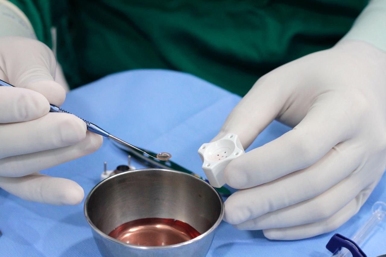 Pernambuco tem alta de 45,6% no número de transplantes