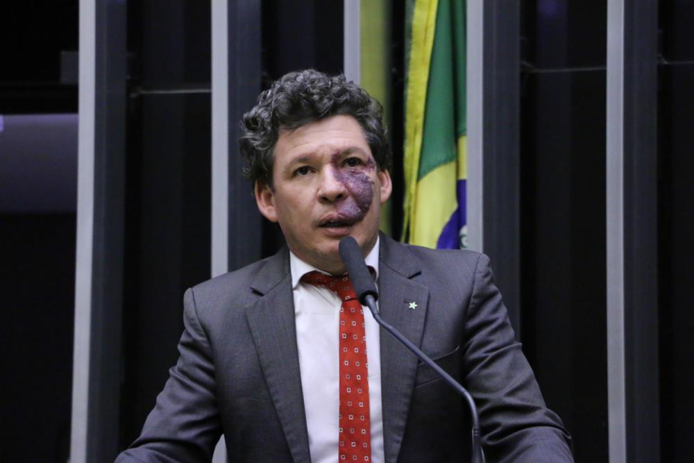 Assista: Líder do PT na Câmara é acusado de violência política contra deputada